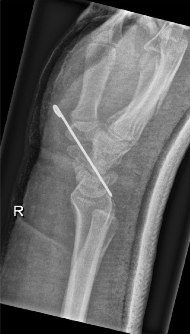 Emergency #29 – European Diploma of Radiology